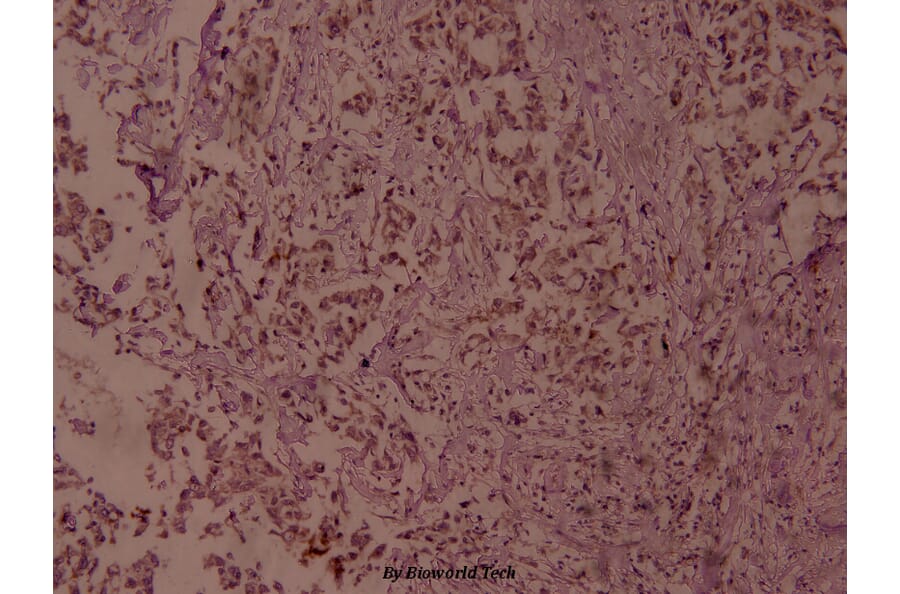 Anti-NFkB-p65 (phospho-S468) Antibody from Bioworld Technology (BS4136) - Antibodies.com