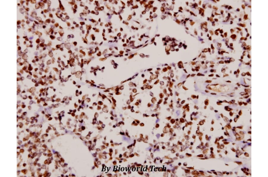 Anti-NFkB-p65 (phospho-S529) Antibody from Bioworld Technology (BS4137) - Antibodies.com