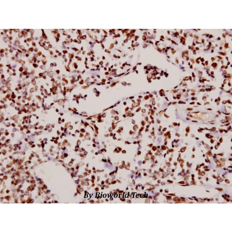 Anti-NFkB-p65 (phospho-S529) Antibody from Bioworld Technology (BS4137) - Antibodies.com