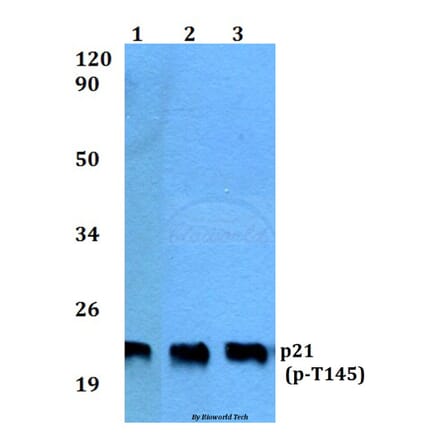 Anti-p21 (phospho-T145) Antibody from Bioworld Technology (BS4142) - Antibodies.com