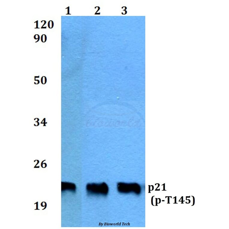 Anti-p21 (phospho-T145) Antibody from Bioworld Technology (BS4142) - Antibodies.com