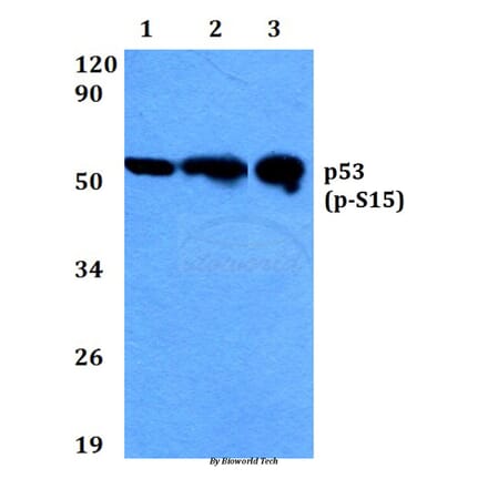 Anti-p53 (phospho-S15) Antibody from Bioworld Technology (BS4144) - Antibodies.com