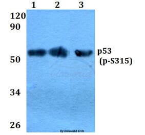Anti-p53 (phospho-S315) Antibody from Bioworld Technology (BS4145) - Antibodies.com