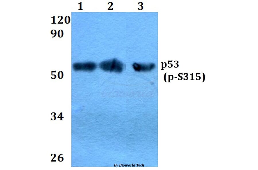 Anti-p53 (phospho-S315) Antibody from Bioworld Technology (BS4145) - Antibodies.com