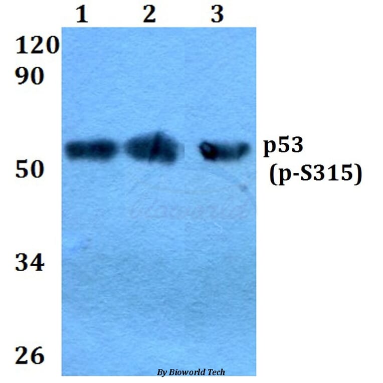 Anti-p53 (phospho-S315) Antibody from Bioworld Technology (BS4145) - Antibodies.com