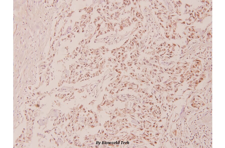 Anti-p53 (phospho-S315) Antibody from Bioworld Technology (BS4145) - Antibodies.com