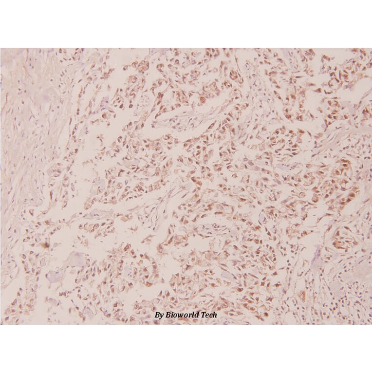 Anti-p53 (phospho-S315) Antibody from Bioworld Technology (BS4145) - Antibodies.com