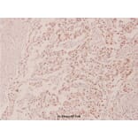 Anti-p53 (phospho-S315) Antibody from Bioworld Technology (BS4145) - Antibodies.com