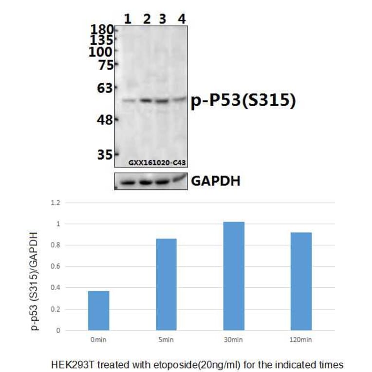 Anti-p53 (phospho-S315) Antibody from Bioworld Technology (BS4145) - Antibodies.com