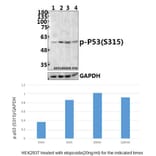 Anti-p53 (phospho-S315) Antibody from Bioworld Technology (BS4145) - Antibodies.com