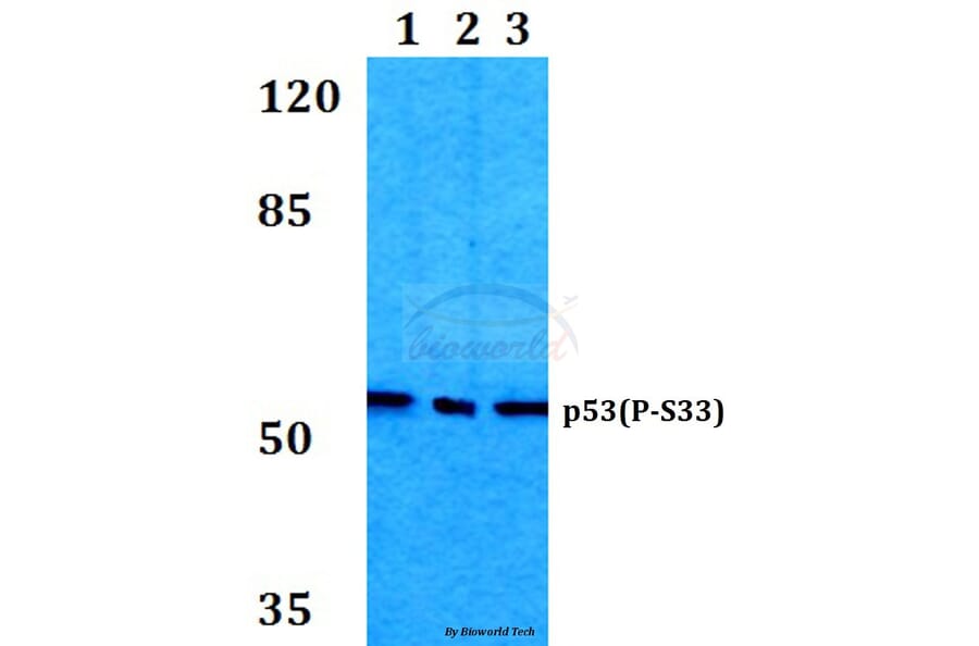 Anti-p53 (phospho-S33) Antibody from Bioworld Technology (BS4146) - Antibodies.com