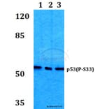 Anti-p53 (phospho-S33) Antibody from Bioworld Technology (BS4146) - Antibodies.com