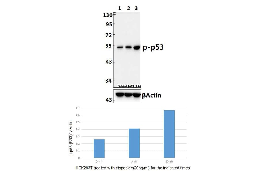 Anti-p53 (phospho-S33) Antibody from Bioworld Technology (BS4146) - Antibodies.com
