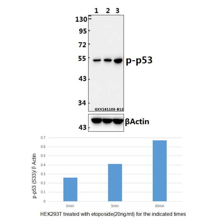 Anti-p53 (phospho-S33) Antibody from Bioworld Technology (BS4146) - Antibodies.com