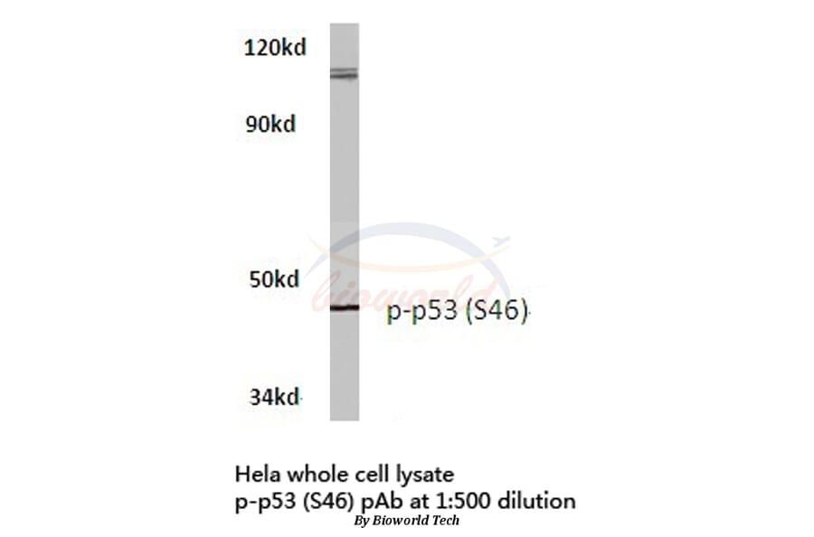 Anti-p53 (phospho-S46) Antibody from Bioworld Technology (BS4147) - Antibodies.com