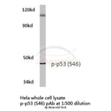 Anti-p53 (phospho-S46) Antibody from Bioworld Technology (BS4147) - Antibodies.com