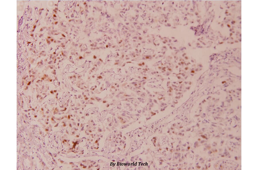 Anti-p53 (phospho-S6) Antibody from Bioworld Technology (BS4148) - Antibodies.com