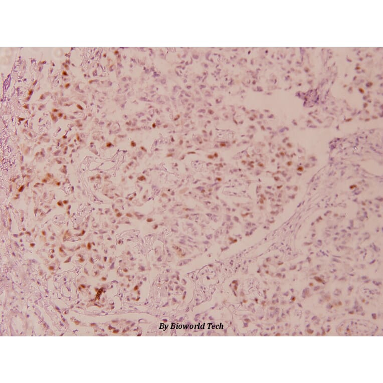 Anti-p53 (phospho-S6) Antibody from Bioworld Technology (BS4148) - Antibodies.com