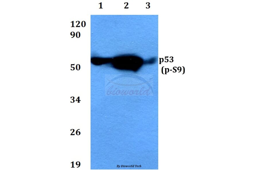 Anti-p53 (phospho-S9) Antibody from Bioworld Technology (BS4149) - Antibodies.com
