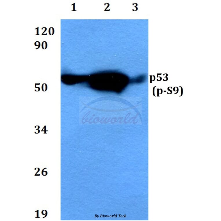 Anti-p53 (phospho-S9) Antibody from Bioworld Technology (BS4149) - Antibodies.com