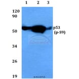 Anti-p53 (phospho-S9) Antibody from Bioworld Technology (BS4149) - Antibodies.com