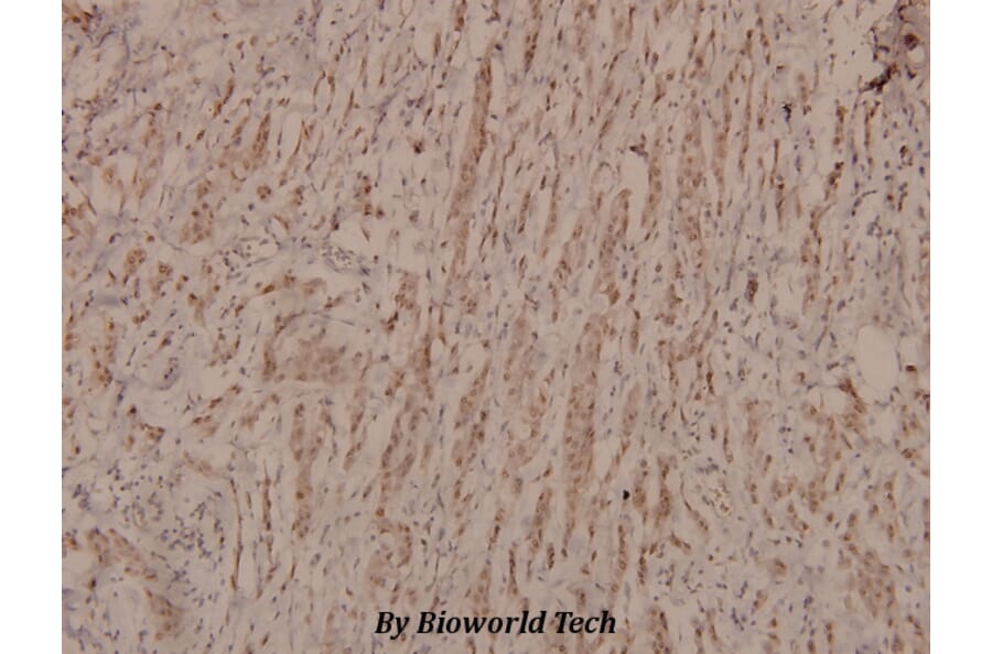 Anti-p53 (phospho-S9) Antibody from Bioworld Technology (BS4149) - Antibodies.com