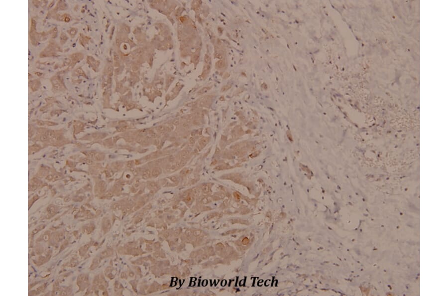 Anti-p73 (phospho-Y99) Antibody from Bioworld Technology (BS4152) - Antibodies.com
