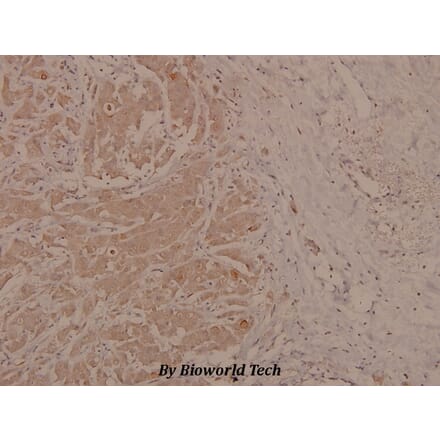 Anti-p73 (phospho-Y99) Antibody from Bioworld Technology (BS4152) - Antibodies.com