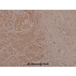 Anti-p73 (phospho-Y99) Antibody from Bioworld Technology (BS4152) - Antibodies.com