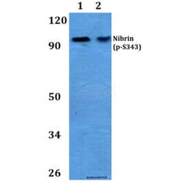 Anti-Nibrin (phospho-S343) Antibody from Bioworld Technology (BS4153) - Antibodies.com