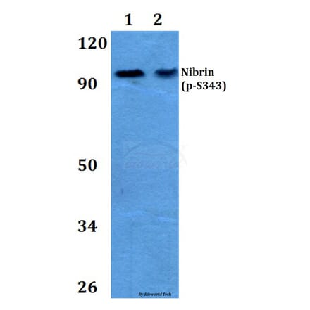 Anti-Nibrin (phospho-S343) Antibody from Bioworld Technology (BS4153) - Antibodies.com