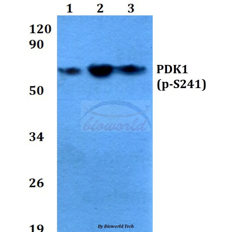 Anti-PDK1 (phospho-S241) Antibody from Bioworld Technology (BS4155) - Antibodies.com