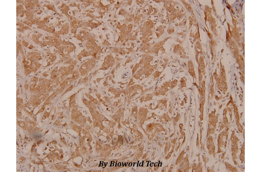 Anti-PDK1 (phospho-S241) Antibody from Bioworld Technology (BS4155) - Antibodies.com