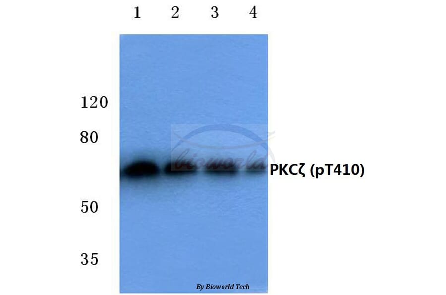 Anti-PKC ζ (phospho-T410) Antibody from Bioworld Technology (BS4156) - Antibodies.com