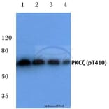 Anti-PKC ζ (phospho-T410) Antibody from Bioworld Technology (BS4156) - Antibodies.com