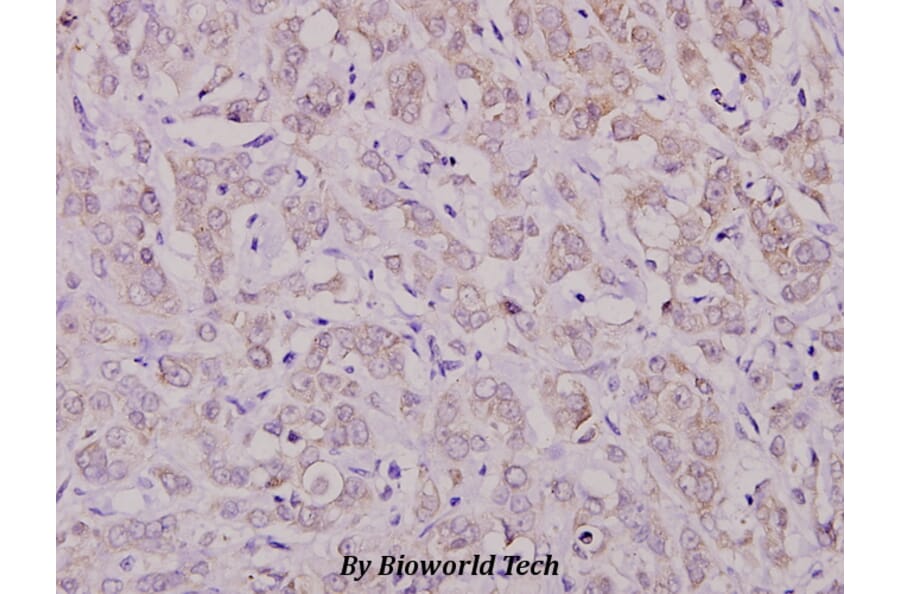 Anti-PKC ζ (phospho-T410) Antibody from Bioworld Technology (BS4156) - Antibodies.com