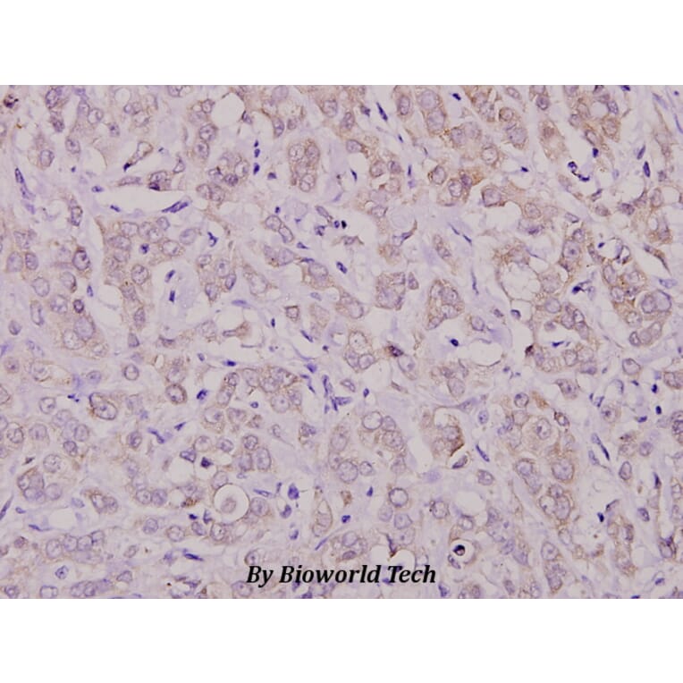Anti-PKC ζ (phospho-T410) Antibody from Bioworld Technology (BS4156) - Antibodies.com