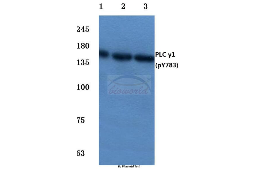Anti-PLC γ1 (phospho-Y783) Antibody from Bioworld Technology (BS4157) - Antibodies.com