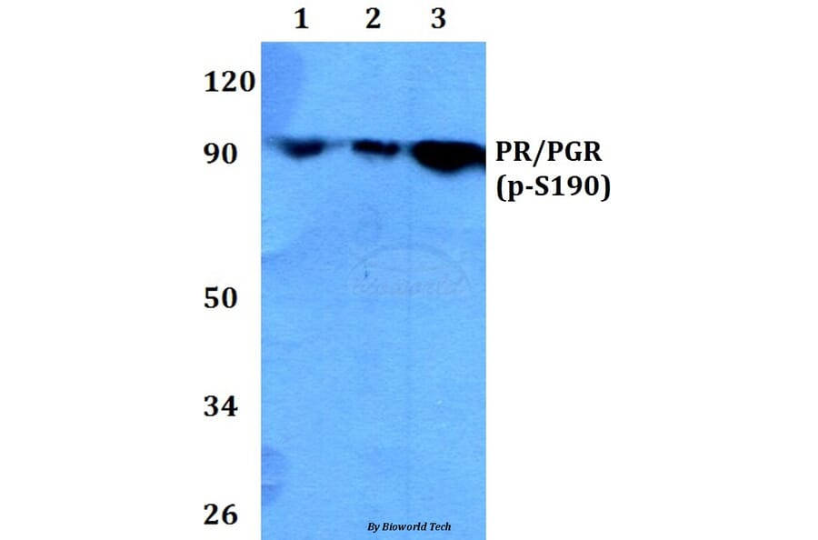 Anti-PR (phospho-S190) Antibody from Bioworld Technology (BS4158) - Antibodies.com
