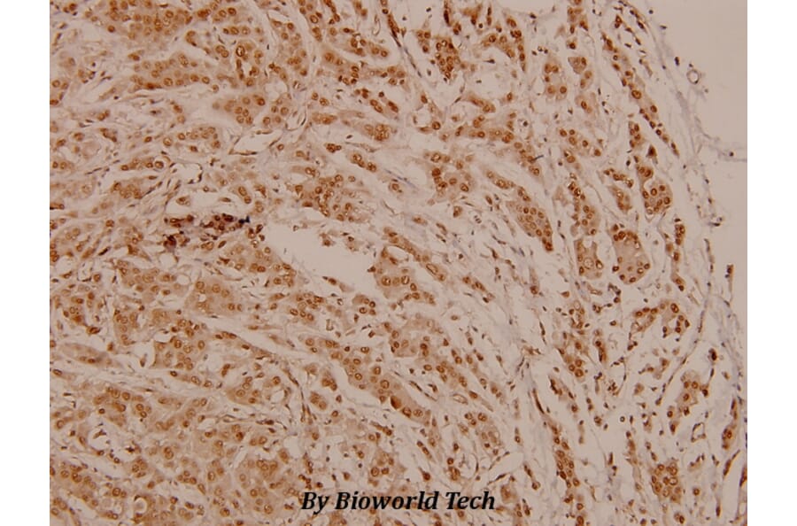 Anti-PR (phospho-S190) Antibody from Bioworld Technology (BS4158) - Antibodies.com
