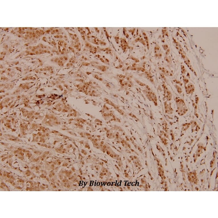 Anti-PR (phospho-S190) Antibody from Bioworld Technology (BS4158) - Antibodies.com