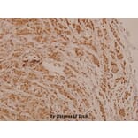 Anti-PR (phospho-S190) Antibody from Bioworld Technology (BS4158) - Antibodies.com