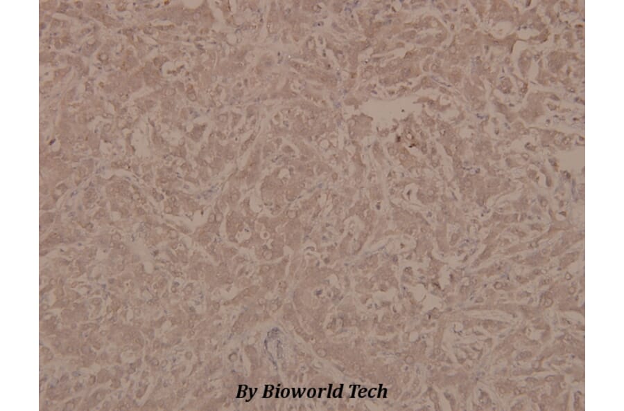 Anti-PTEN (phospho-S370) Antibody from Bioworld Technology (BS4159) - Antibodies.com