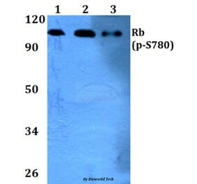 Anti-Rb (phospho-S780) Antibody from Bioworld Technology (BS4164) - Antibodies.com