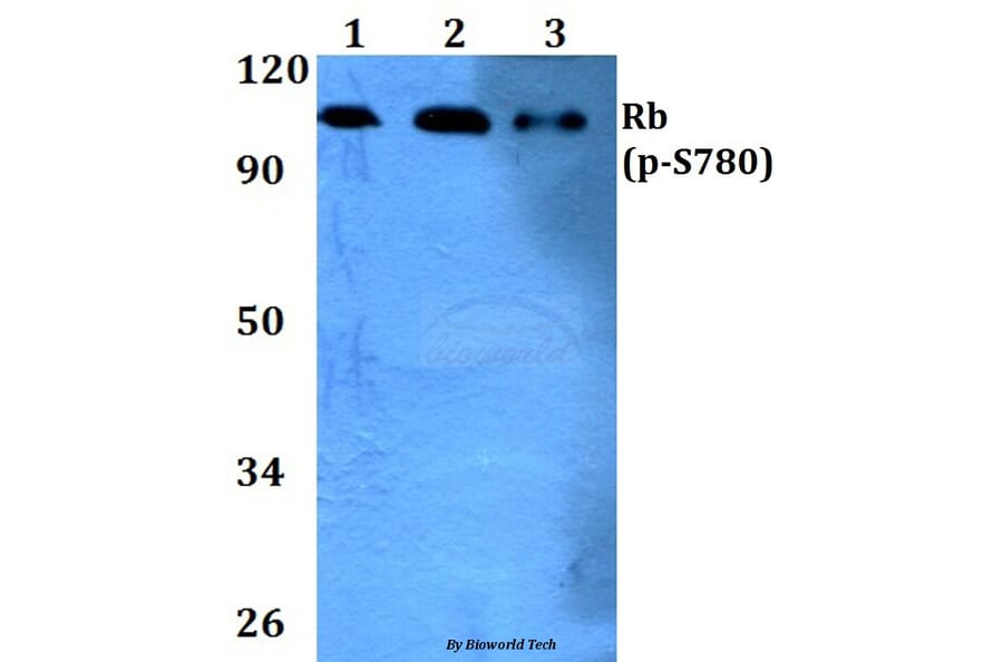 Anti-Rb (phospho-S780) Antibody from Bioworld Technology (BS4164) - Antibodies.com