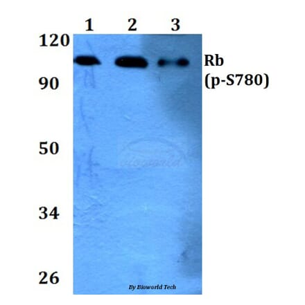 Anti-Rb (phospho-S780) Antibody from Bioworld Technology (BS4164) - Antibodies.com