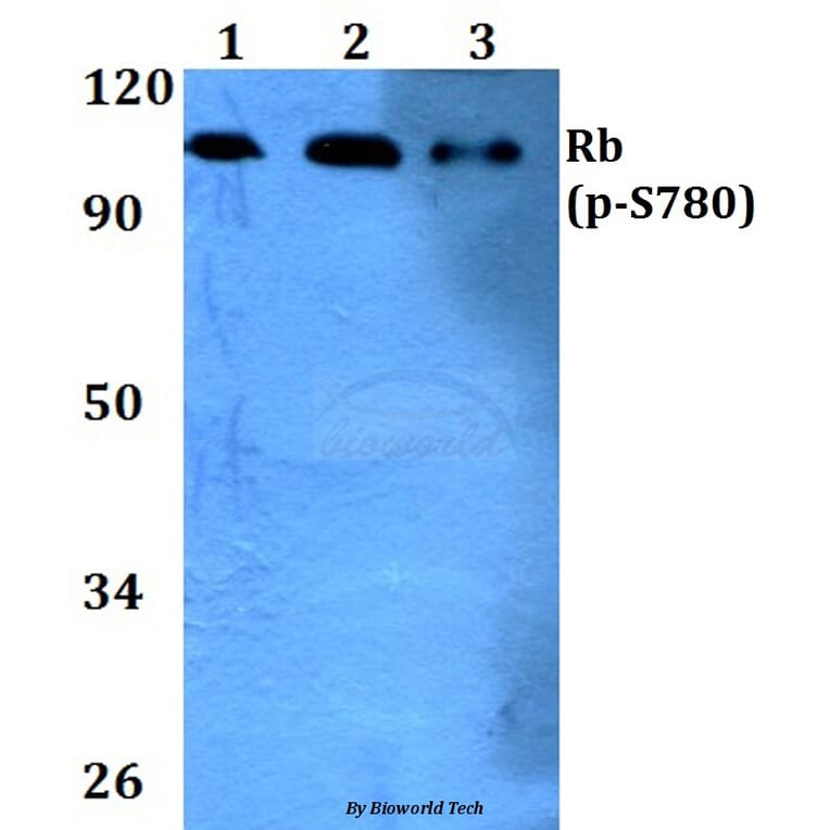 Anti-Rb (phospho-S780) Antibody from Bioworld Technology (BS4164) - Antibodies.com