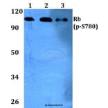 Anti-Rb (phospho-S780) Antibody from Bioworld Technology (BS4164) - Antibodies.com