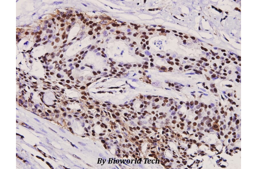 Anti-Rb (phospho-S780) Antibody (A27443) | Antibodies.com