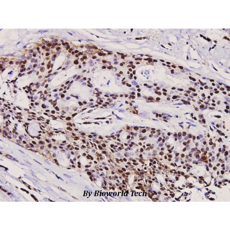Anti-Rb (phospho-S780) Antibody from Bioworld Technology (BS4164) - Antibodies.com
